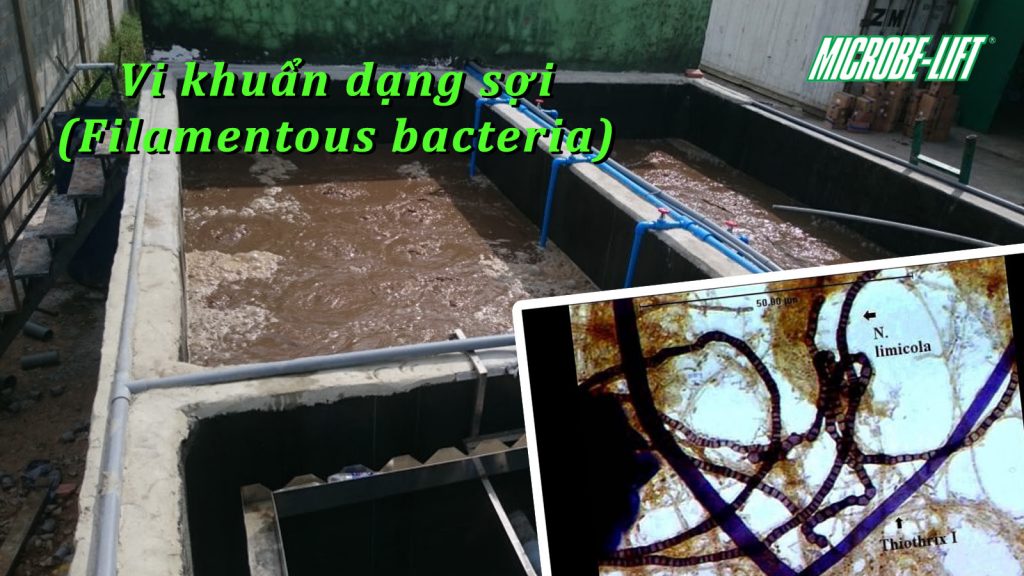 Vi khuẩn dạng sợi (Filamentous bacteria)